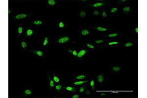 Image no. 1 for anti-Inhibitor of Growth Family, Member 4 (ING4) (AA 1-249) antibody (ABIN526498)