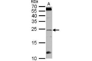RGS4 antibody