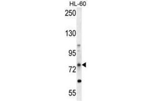 Image no. 3 for anti-ATP-Binding Cassette, Sub-Family D (Ald), Member 1 (ABCD1) (AA 264-293), (Middle Region) antibody (ABIN950202)