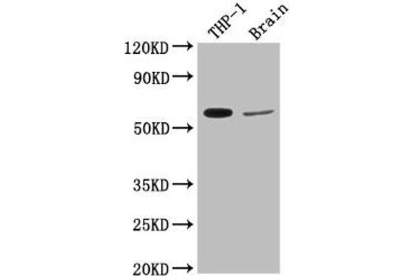 Collagen Type IX alpha 2 (COL9A2) (AA 594-611) antibody