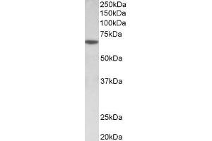 Image no. 1 for anti-SRY (Sex Determining Region Y)-Box 11 (SOX11) (AA 309-323) antibody (ABIN870691)