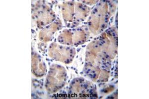 Image no. 1 for anti-Carboxylesterase 4A (CES4A) (AA 532-561), (C-Term) antibody (ABIN951486)