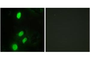 Image no. 2 for anti-Ets Variant 6 (ETV6) (AA 371-420) antibody (ABIN1533723)