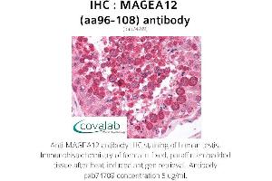 Image no. 1 for anti-Melanoma Antigen Family A, 12 (MAGEA12) (AA 96-108) antibody (ABIN1736672)
