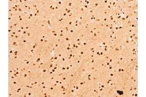 ABIN6267306 at 1/100 staining rat brain tissue sections by IHC-P.
