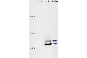 Image no. 3 for anti-Phosphoinositide-3-Kinase, Catalytic, beta Polypeptide (PIK3CB) (pSer1070) antibody (ABIN872304)
