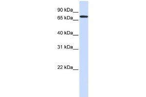 Image no. 1 for anti-UDP-N-Acetyl-alpha-D-Galactosamine:polypeptide N-Acetylgalactosaminyltransferase 6 (GalNAc-T6) (GALNT6) (Middle Region) antibody (ABIN2782759)