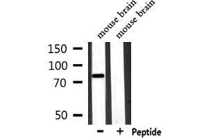 Image no. 1 for anti-Protein Kinase C, gamma (PRKCG) (pThr655) antibody (ABIN6271960)