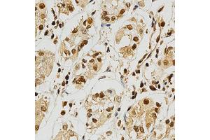 Image no. 1 for anti-Nuclear Factor of Activated T-Cells, Cytoplasmic, Calcineurin-Dependent 1 (NFATC1) antibody (ABIN3022101)