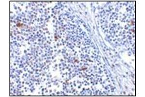 Image no. 2 for anti-Interferon Induced with Helicase C Domain 1 (IFIH1) (Center) antibody (ABIN500266)
