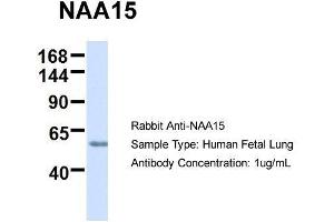 Image no. 3 for anti-N(alpha)-Acetyltransferase 15, NatA Auxiliary Subunit (NAA15) (N-Term) antibody (ABIN2783595)