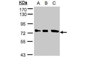 Image no. 3 for anti-Optineurin (OPTN) (Center) antibody (ABIN2856108)