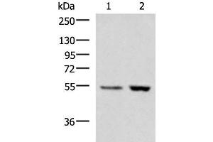 Western blot analysis of Human placenta tissue LOVO cell lysates using ZSWIM1 Polyclonal Antibody at dilution of 1:550