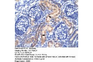 Image no. 6 for anti-phosphoenolpyruvate Carboxykinase 1 (Soluble) (PCK1) (Middle Region) antibody (ABIN2777603)