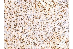 Image no. 7 for anti-Epidermal Growth Factor Receptor (EGFR) (pSer695) antibody (ABIN6255471)