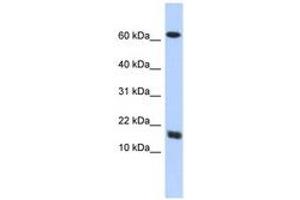 Image no. 1 for anti-Chromosome 4 Open Reading Fram 46 (C4orf46) (AA 35-84) antibody (ABIN6741114)