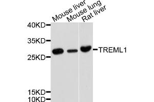 Image no. 1 for anti-Triggering Receptor Expressed On Myeloid Cells-Like 1 (TREML1) antibody (ABIN6566919)
