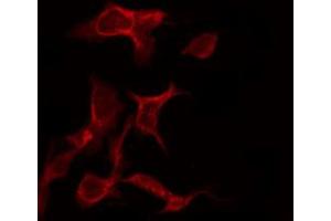 Image no. 1 for anti-Epidermal Growth Factor Receptor (EGFR) (pSer695) antibody (ABIN6255471)