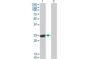 Image no. 2 for anti-Catechol-O-Methyltransferase (COMT) (AA 1-182) antibody (ABIN560435)
