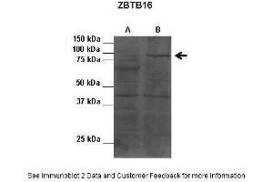 Image no. 3 for anti-Zinc Finger and BTB Domain Containing 16 (ZBTB16) (C-Term) antibody (ABIN2780737)