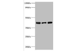 ST8SIA2 anticorps  (AA 24-160)