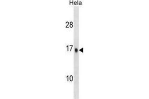 Image no. 1 for anti-Ubiquitin-Conjugating Enzyme E2D 3 (UBE2D3) (AA 108-136), (C-Term) antibody (ABIN955425)