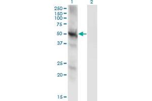 Western Blot analysis of PPP3CC expression in transfected 293T cell line by PPP3CC monoclonal antibody (M01), clone 4D1.