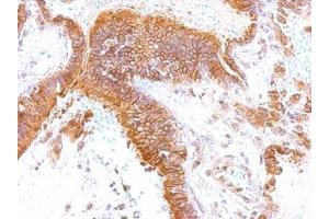 IHC-P Image GEM antibody [N1], N-term detects GEM protein at membrane on human lung by immunohistochemical analysis.