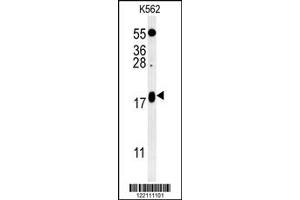 Image no. 1 for anti-Vesicle-Associated Membrane Protein 4 (VAMP4) (Center) antibody (ABIN2493686)