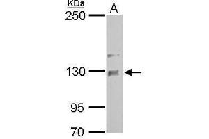 anti-NCK Associated Protein 1 (NCKAP1) (Internal Region) antibody