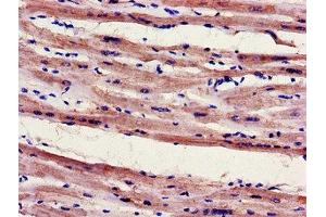 FILIP1 anticorps  (AA 957-1192)