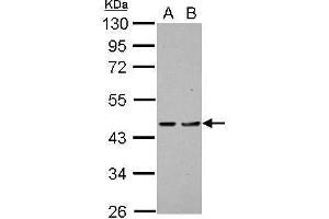 WB Image Sample (30 ug of whole cell lysate) A: H1299 B: HCT116 10% SDS PAGE antibody diluted at 1:1000