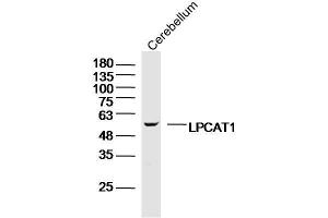 Image no. 1 for anti-Lysophosphatidylcholine Acyltransferase 1 (LPCAT1) (AA 1-100) antibody (ABIN5675397)
