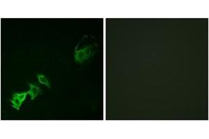Immunofluorescence analysis of A549 cells, using Abl (Phospho-Tyr393/412) Antibody.