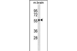 Image no. 2 for anti-Mitogen-Activated Protein Kinase 4 (MAPK4) (AA 67-94), (N-Term) antibody (ABIN5534252)