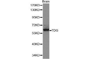 Image no. 1 for anti-Thymine-DNA Glycosylase (TDG) antibody (ABIN1513594)