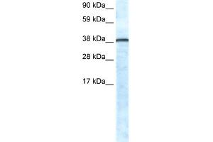 Image no. 1 for anti-Growth Factor Independent 1 (GFI1) (N-Term) antibody (ABIN2779720)