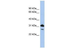 Image no. 1 for anti-RAP1B, Member of RAS Oncogene Family (RAP1B) (N-Term) antibody (ABIN631250)