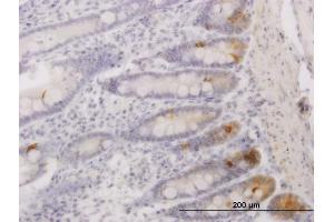 Image no. 3 for anti-A Kinase (PRKA) Anchor Protein 17A (AKAP17A) (AA 53-156) antibody (ABIN563567)