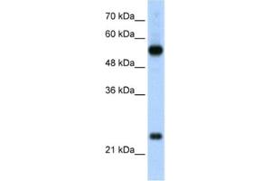 Image no. 1 for anti-Ribosomal Protein L13 (RPL13) antibody (ABIN2462056)