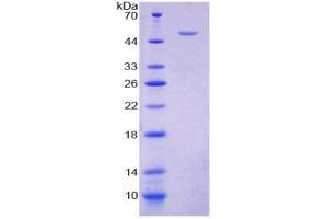 Image no. 1 for Cytohesin 2 (CYTH2) (AA 1-390) protein (His tag) (ABIN6237935)