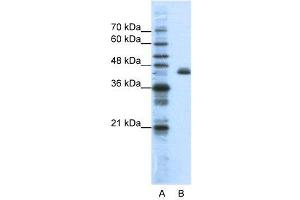 Image no. 2 for anti-Zinc Finger Protein 36, C3H Type-Like 2 (ZFP36L2) (N-Term) antibody (ABIN2780810)