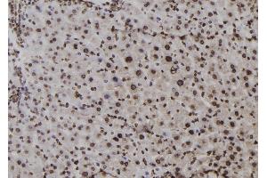 Image no. 1 for anti-Activating Transcription Factor 1 (AFT1) (pSer198) antibody (ABIN6269917)