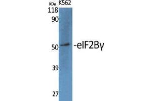 Image no. 2 for anti-Eukaryotic Translation Initiation Factor 2B, Subunit 3 Gamma, 58kDa (EIF2B3) (Internal Region) antibody (ABIN3180602)
