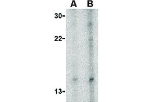 Image no. 2 for anti-Neuritin 1 (NRN1) (Internal Region) antibody (ABIN6655827)