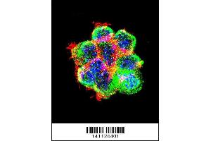 Image no. 6 for anti-Catenin (Cadherin-Associated Protein), beta 1, 88kDa (CTNNB1) (AA 692-721), (C-Term) antibody (ABIN1881238)