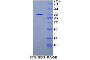 Image no. 1 for Cardiac Troponin I (TNNI3) (AA 1-211) protein (His tag) (ABIN1821597)