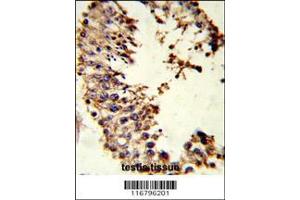 Image no. 1 for anti-Acrosin (ACR) (AA 99-127) antibody (ABIN653022)