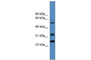 Image no. 1 for anti-Leucine Rich Repeat (In FLII) Interacting Protein 2 (LRRFIP2) (N-Term) antibody (ABIN929113)