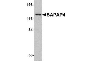 Image no. 1 for anti-Discs, Large (Drosophila) Homolog-Associated Protein 4 (DLGAP4) (Middle Region) antibody (ABIN1031078)